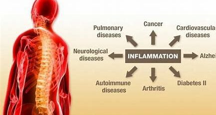 CBD for Inflammation: Natural Relief and Wellness
